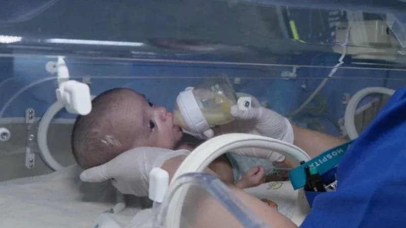 İstanbul’da 500 gram bebek hayata tutunmayı başardı