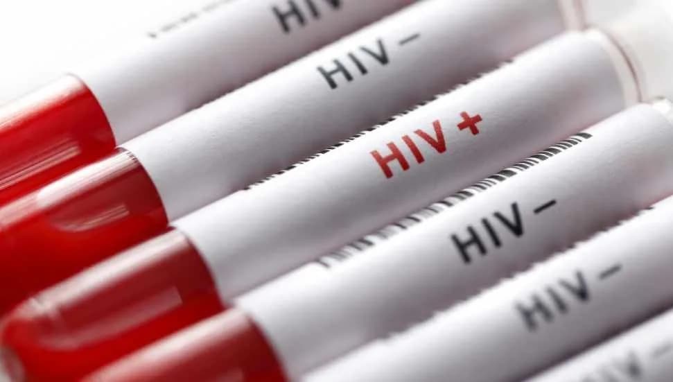 HIV fonları 2,1 milyar dolar eridi: Uzmanlardan AIDS salgını uyarısı