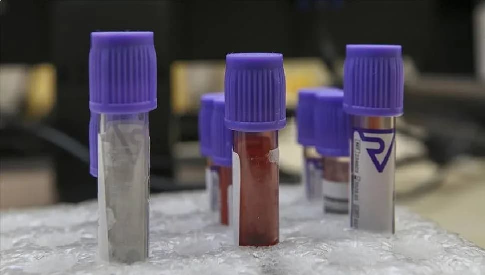 Evde yapılan test, mesane kanserini yüzde 90 doğrulukla tespit ediyor
