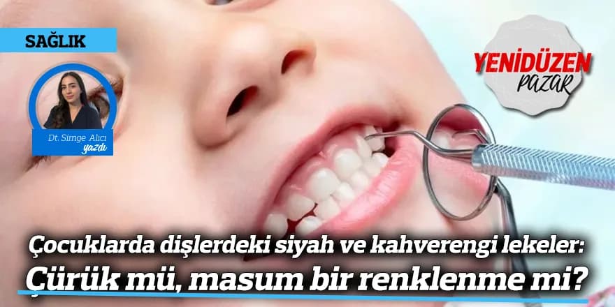 Çocuklarda dişlerdeki siyah ve kahverengi lekeler: Çürük mü, masum bir renklenme mi?