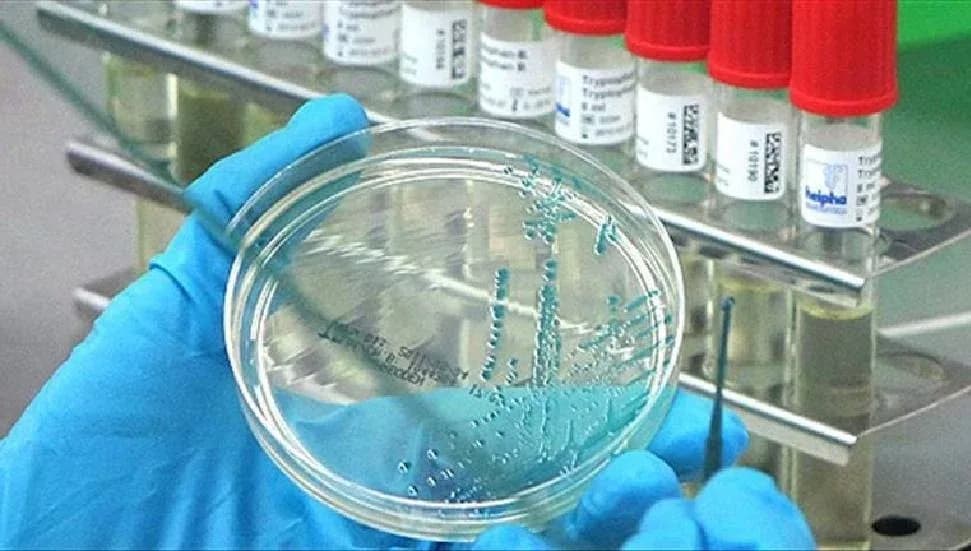 Güney Kıbrıs’ta kuş gribi alarmı: 4 kişi karantinaya alındı