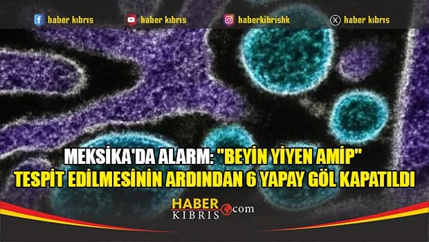 Meksika'da alarm: "Beyin yiyen amip" tespit edilmesinin ardından 6 yapay göl kapatıldı