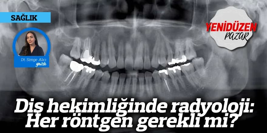 Diş hekimliğinde radyoloji: Her röntgen gerekli mi?