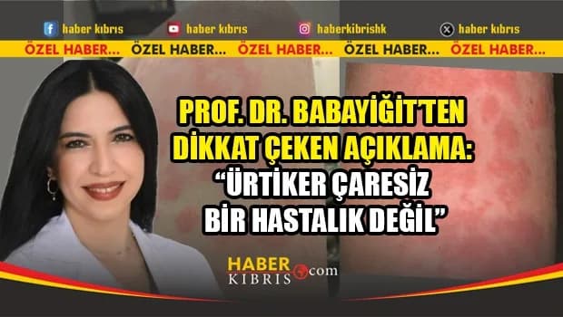 Toplumda sık görülen ama az bilinen bir tablo: Ürtiker hakkında gerçekler