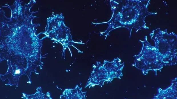 Prostat kanserinin erken teşhisinde yeni ipucu